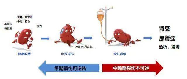 警示与探索：尿毒症最新进展揭秘，揭开治疗与管理的新面纱